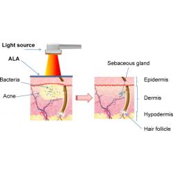 Super Acne Clear