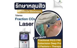 ใหม่ !! โปรคอมโบเลเซอร์ผีลืมหลุม 3,999 ฿ !!