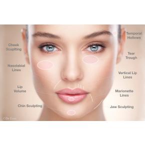ฉีดฟิลเลอร์ (Intradermal Filler) ย้อนอายุ
